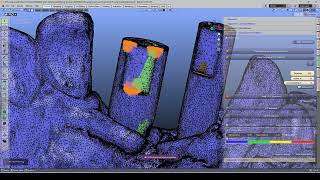 🦷 Scanbody Alignment. Changing Refinement