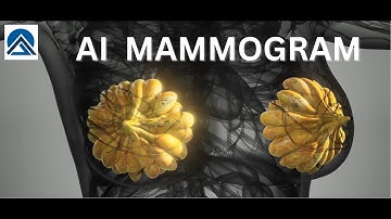Revolutionizing Breast Cancer Detection: The Artificial Intelligence Mammogram Breakthrough #ai #agi