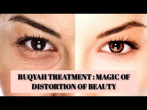 Ruqyah Treatment: Distortion of Beauty Due To Black Magic, Evil Eye, Envy