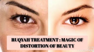 Ruqyah Treatment: Distortion of Beauty Due To Black Magic, Evil Eye, Envy screenshot 5