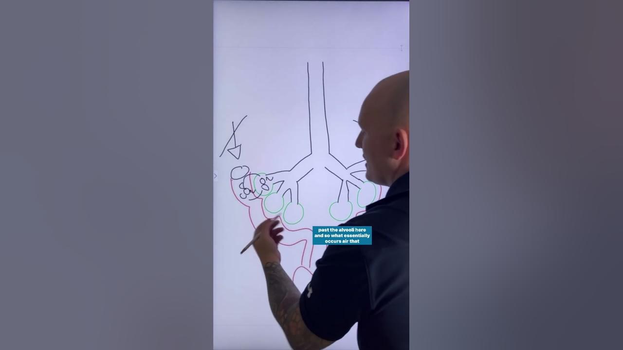 Low ETCO2 in Pulmonary Embolism? YouTube