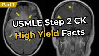 USMLE Step 2 CK High Yield Facts (Part 1)