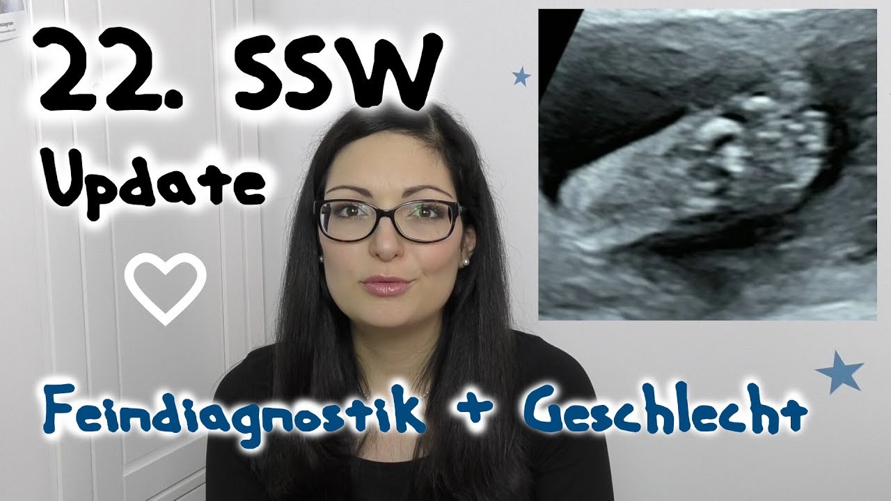 22-ssw-schwangerschafts-update-feindiagnostik-geschlecht-q-a-anncooki