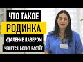 Что такое родинка (невус). Удаление родинки лазером и что делать если чешется и воспалилась родинка