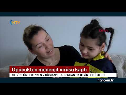 Öpücükten menenjit virüsü kaptı ... (9 yaşındaki Ecrin'in hikayesi)