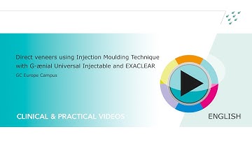 Direct veneers using Injection Moulding Technique with G-ænial Universal Injectable and EXACLEAR