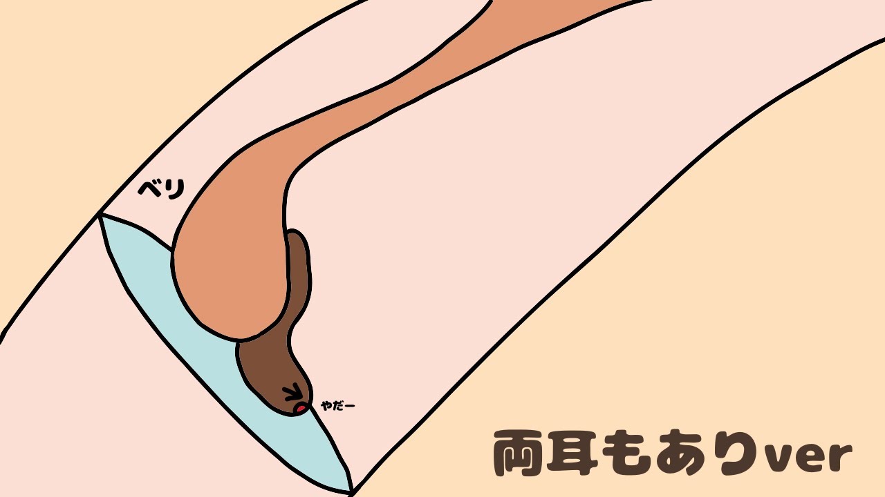 鼓膜から剥がれた感覚のあるごりごり耳かき 両耳もありver | No Talking ASMR | Ear Cleaning