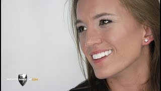 The Future of Dental Veneers - No Cosmetic Dentist Needed! The Future of Dental Veneers - No Cosmetic Dentist Needed!