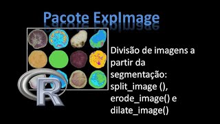 [Package ExpImage] 19. Divisão de imagens a partir da segmentação: split_image ()