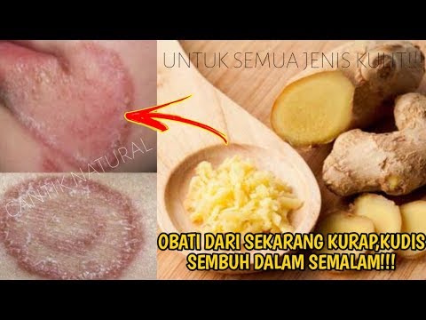 AJAIB! cara menyembuhkan Penyakit kulit Kudis, kurap dengan bahan alami