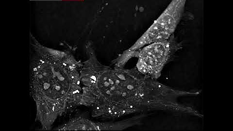 Label-free live cell imaging of primary human keratinocytes for 13 hours