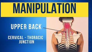 Spinal manipulation (HVT / Grade 5) to the Cervical-Thoracic Junction