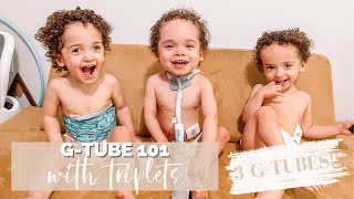 G-TUBE TRIPLETS!!! (feeding tube 101, fave products, etc.)