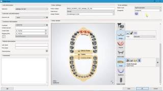 How to order  Maryland Bridge Design in 3Shape Dental System 2016