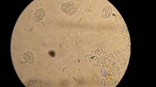 Parasiet Chilodonella Opname Microscoop 400X
