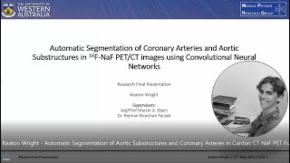 Famous Keaton Wright - Automatic Segmentation of Aortic Substructures and Coronary Arteries in Cardiac CT Wealth