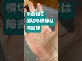 生命線を横切る横線は障害線。体に気をつける。休息をとりましょう