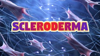 Scleroderma (updated 2023) - CRASH! Medical Review Series