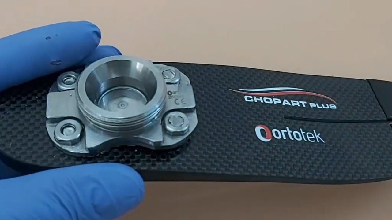 Too high to be used for chopart amputation level