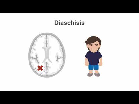 Pinpointing lesions to the occipital lobes