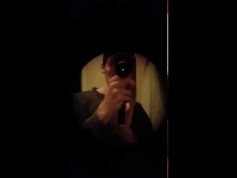 Undilated exam of own fundus with smartphone and PanOptic ophthalmoscope using a home-made adapter