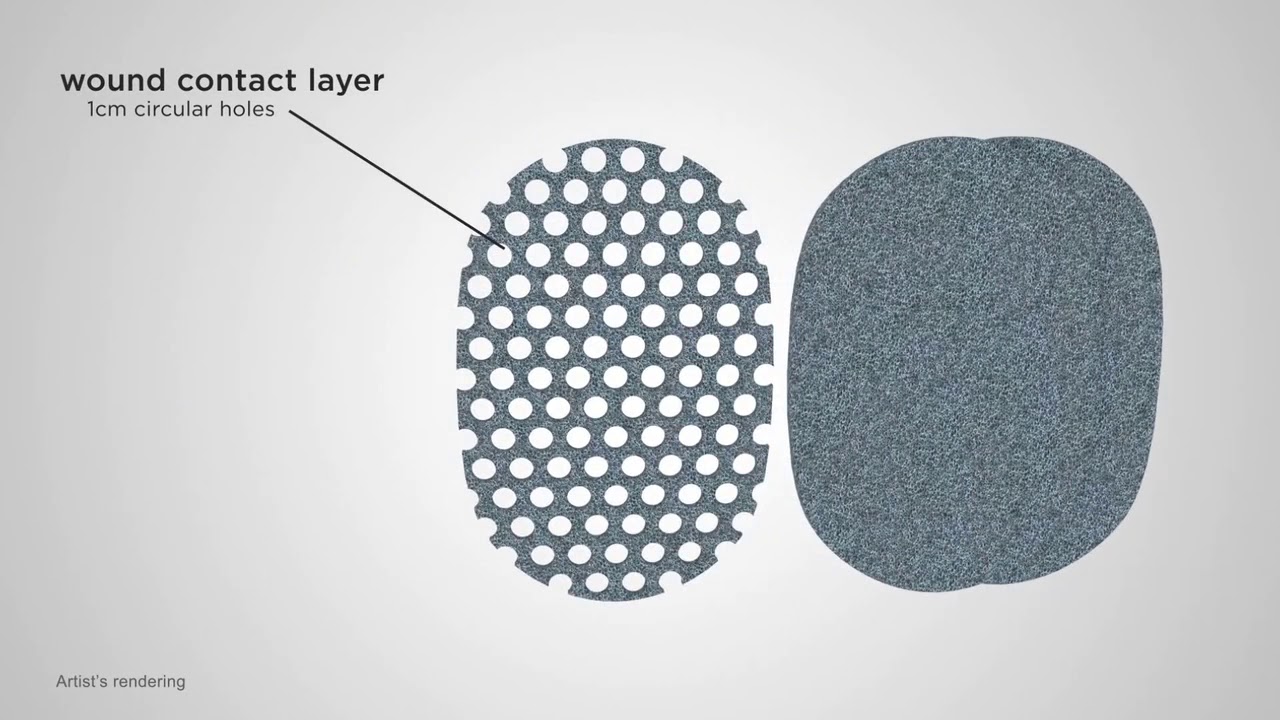 Topper Acelity Acelity V A C ULTA™ Negative Pressure Wound Therapy System - YouTube