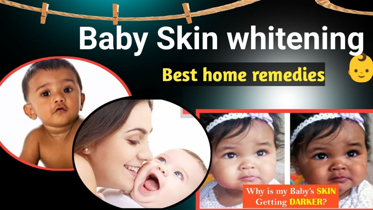 बच्चे के रंग को गोरा कैसे करेbaby skin care home remedies for baby