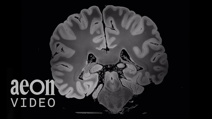 Neurosymphony: An unprecedented glimpse inside the...