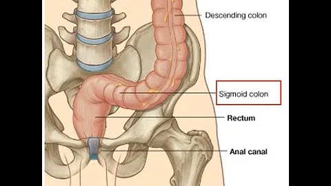 ¿Qué profundidad tiene el colon sigmoide?