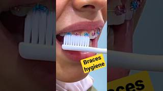 كيف تنظف تقويم الأسنان في ثواني Braces teeth hygiene viral shorts video education patience