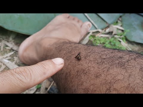 Video: Apa Yang Menggigit Lalat
