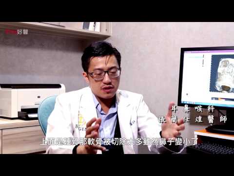 『-鼻重修-鼻翼過度切除變太窄時還能修復嗎?』#Pro好醫大聯盟