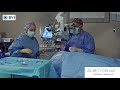 Cataract surgery with revo smart