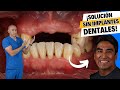 Te faltan dientes y no quieres implantes solucin asequible  dentadura removible