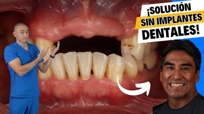 Pongo a prueba producto de  para hacer DIENTES en casa