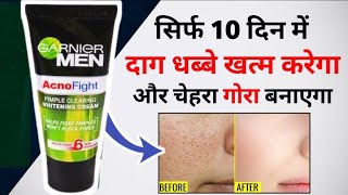 Garnier Men Acno Fight Cream इसतमल करन क सह तरक