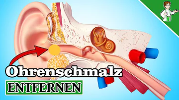 Wie tief sitzt Ohrenschmalz?