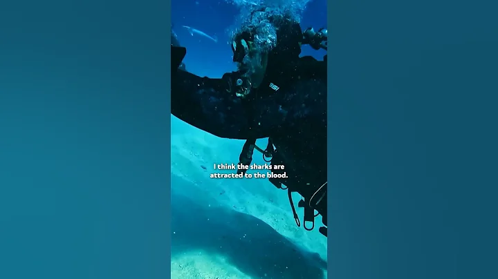 Paul's Arm Is Ripped Off | How to Survive a Shark Attack | Shark Week