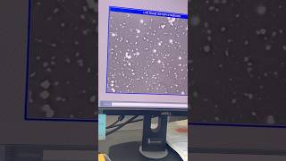 Semen analysis