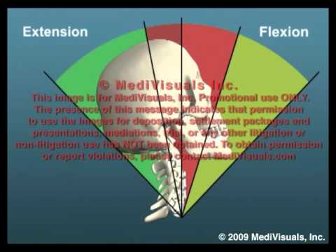 Cervical Flexion Extension Range of Motion