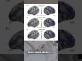 AI Maps the Brain's Multimodal World!