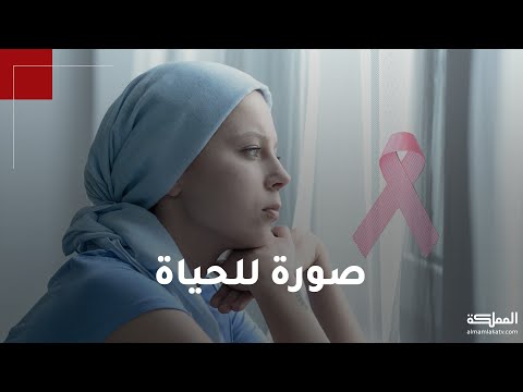 سرطان الثدي الأكثر انتشارا بين النساء في الأردن 95 نسبة الشفاء منه في حال الكشف المبكر