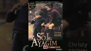 SOL AYAĞIM...