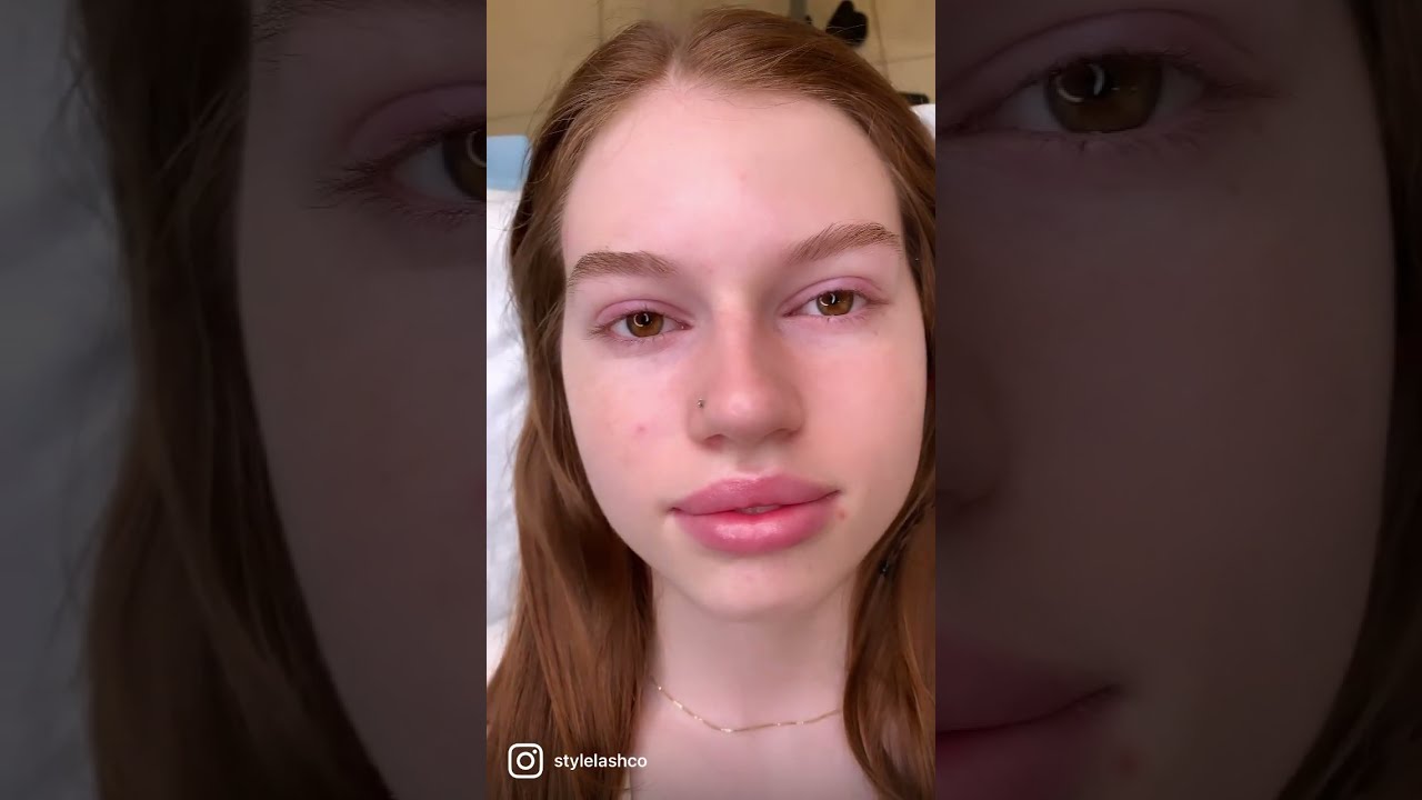 Lash Extension Removal