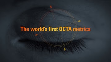 AngioAnalytics™ by Optovue, the world