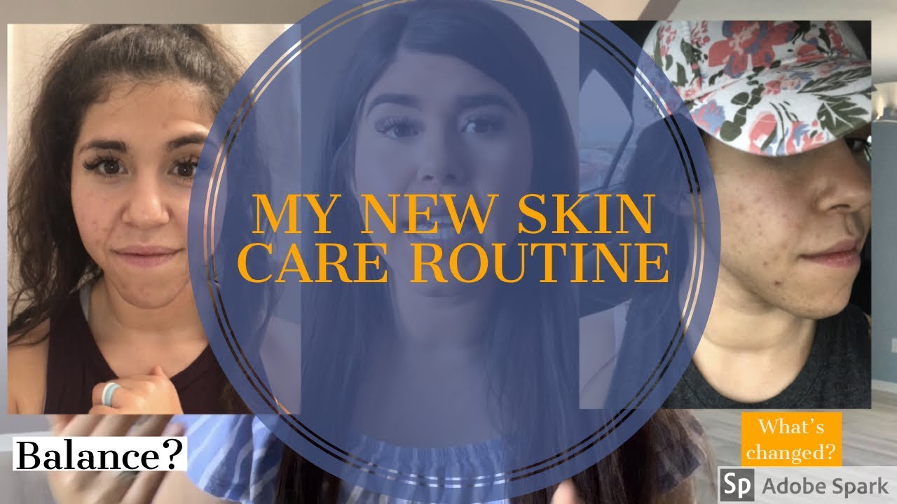 SAVING MY FACE FROM ACNE