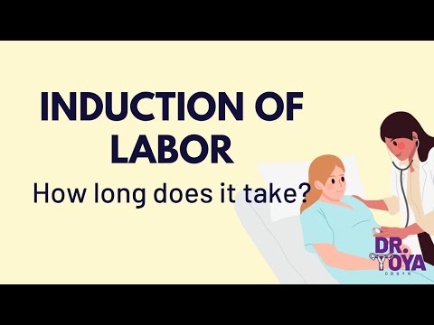 How long is an induction of labor?