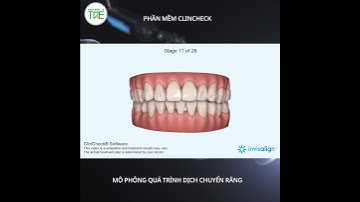 𝑽𝒊𝒅𝒆𝒐: 𝑲𝒆̂́ 𝒉𝒐𝒂̣𝒄𝒉 𝑪𝒍𝒊𝒏𝒄𝒉𝒆𝒄𝒌 𝒗𝒂̀ 𝑨̉𝒏𝒉 𝒕𝒓𝒖̛𝒐̛́𝒄 𝒔𝒂𝒖 𝒕𝒉𝒖̛̣𝒄 𝒕𝒆̂́ 𝒄𝒖̉𝒂 𝒌𝒉𝒂́𝒄𝒉 𝒉𝒂̀𝒏𝒈 𝑵𝒉𝒂 𝒌𝒉𝒐𝒂 𝑻𝒓𝒆̉