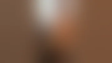 Beautiful Breast Lift Result Los Angeles Dr David Stoker 