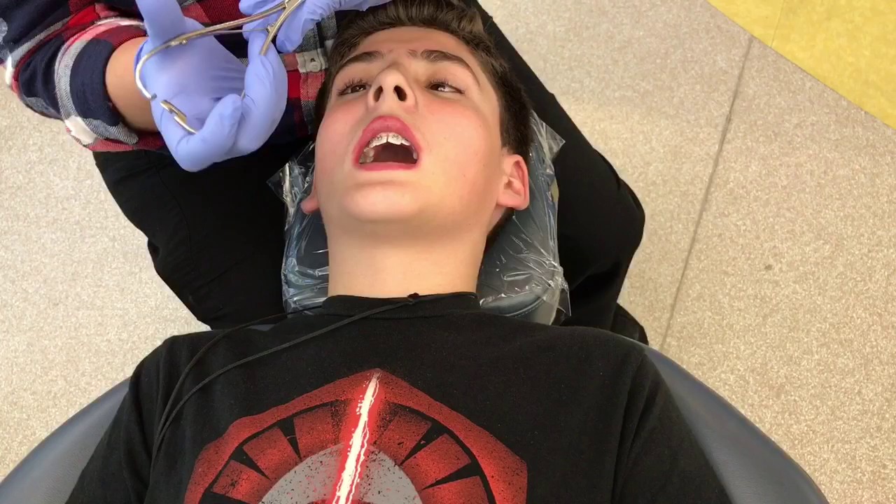 Bradley's Braces YouTube